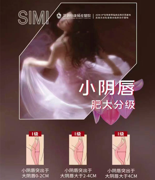 大陸陰唇整形價錢幾多?小陰唇縮 大陸陰唇整形價錢幾多?小陰唇縮